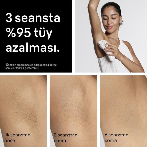 Braun Ipl Silk·expert Pro 5, Evde Lazerle Tüy Alma, Çanta, Gillette Venus, 2 Başlık, PL5251